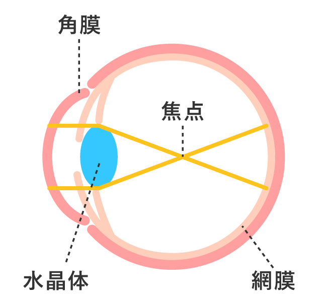 近視の状態