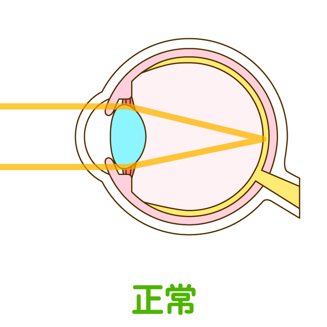 正常